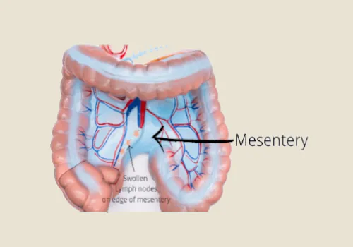 Mesenteric Adenitis foods to avoid