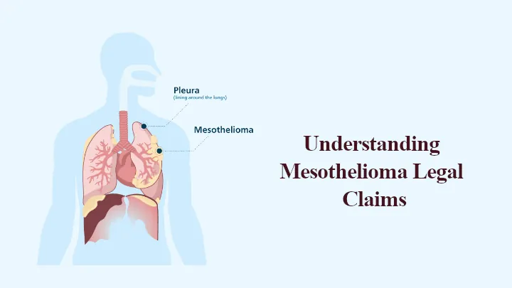 Understanding Mesothelioma Legal Claims