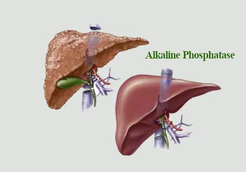 Foods to Avoid if Alkaline Phosphatase is High