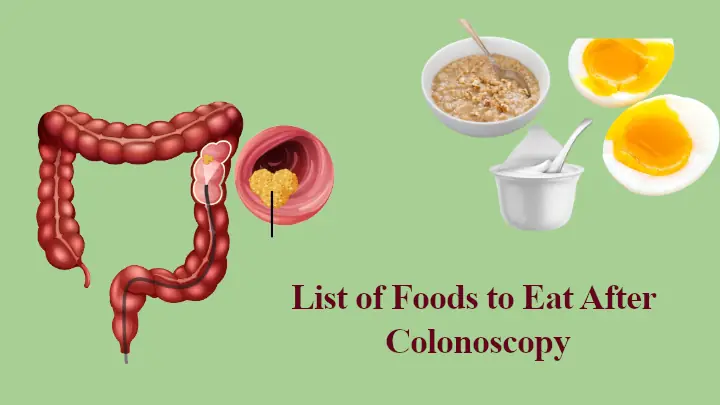 List of Foods to Eat After Colonoscopy