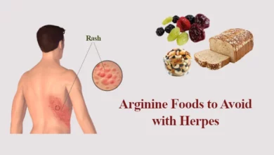Arginine Foods to Avoid with Herpes