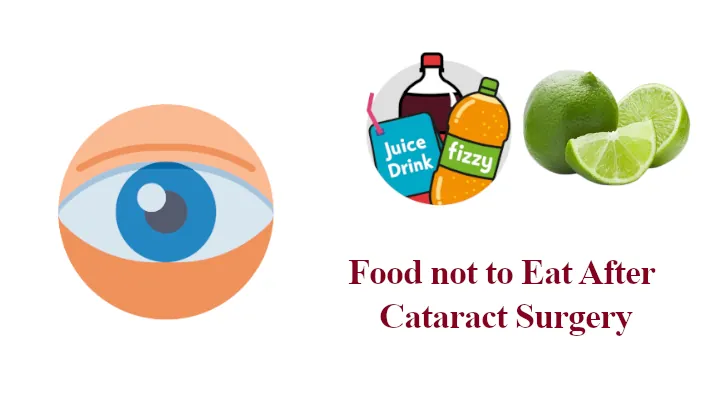 Food not to Eat After Cataract Surgery