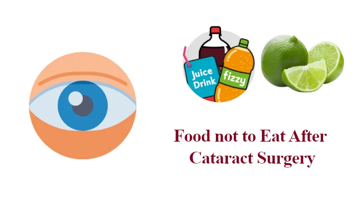 11-food-not-to-eat-after-cataract-surgery