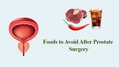 Foods to Avoid After Prostate Surgery