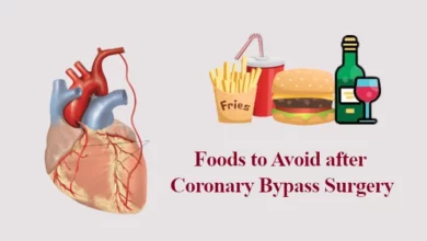 Foods to Avoid after Coronary Bypass Surgery