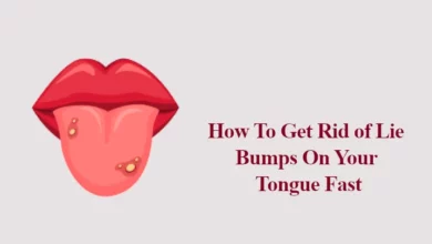 How To Get Rid of Lie Bumps On Your Tongue Fast
