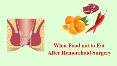 What Food not to Eat After Hemorrhoid Surgery