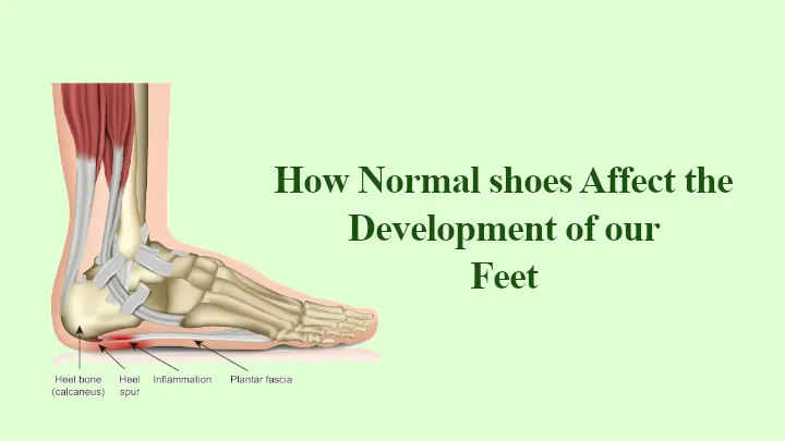 How do Normal shoes Affect the Development of our Feet?