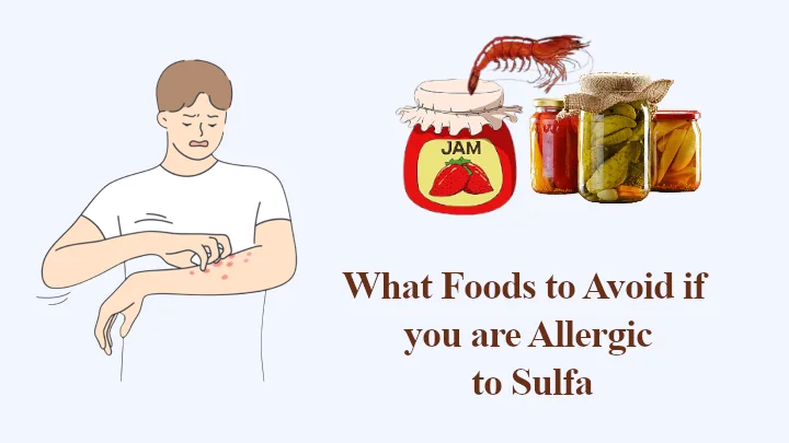 What Foods to Avoid if you are Allergic to Sulfa