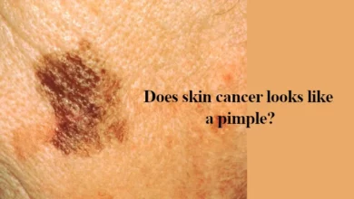skin cancer looks like a pimple