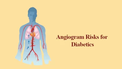 Angiogram Risks for Diabetics