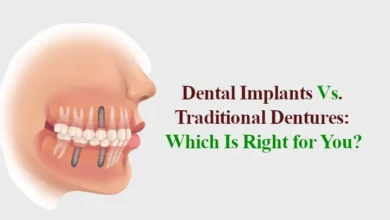 Dental Implants Vs Traditional Dentures