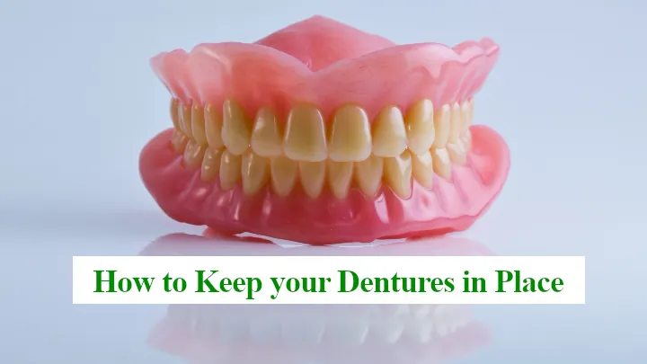 How to Keep your Dentures in Place