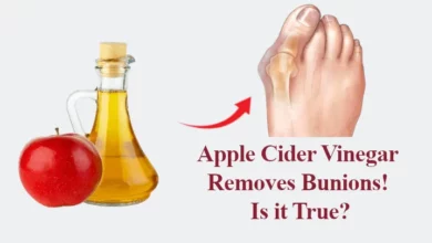 Apple Cider Vinegar Removes Bunions