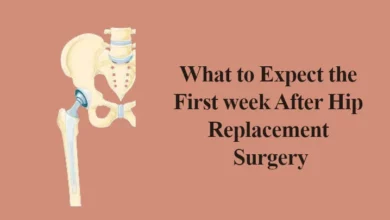 What to Expect the First week After Hip Replacement Surgery
