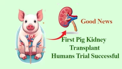 Pig kidney transplant humans Trial