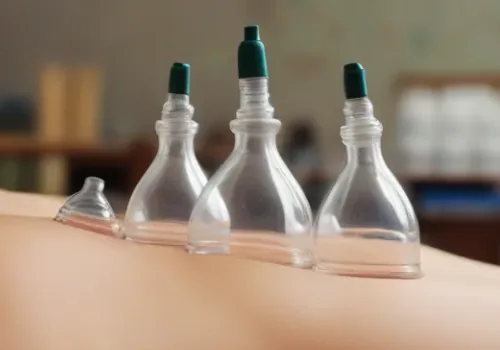 what is butt cupping