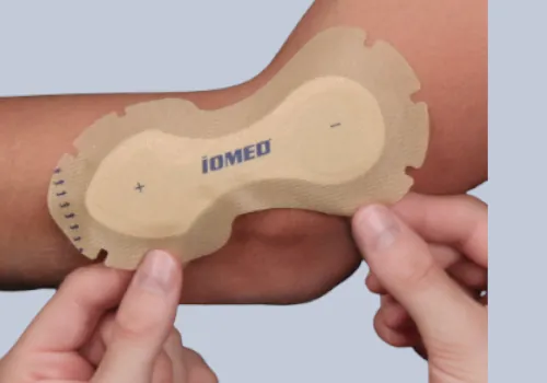 What is iontophoresis patch