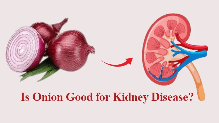 Is Onion Good for Kidney Disease