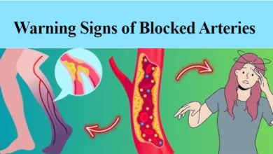 Warning Signs of Blocked Arteries