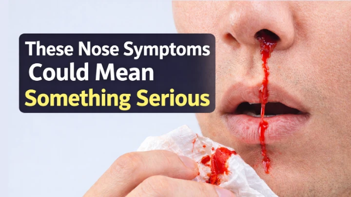 Nose Symptoms