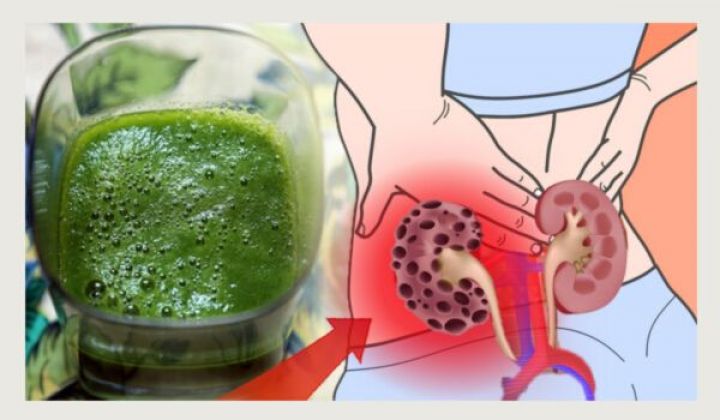 KIDNEY CLEANSE NATURAL REMEDIES
